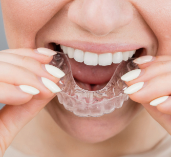 Invisalign